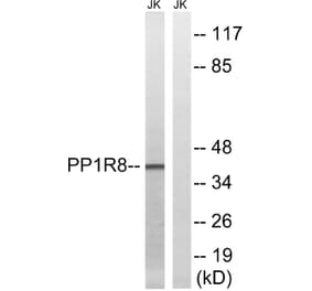 Western Blot - Anti-PPP1R8 Antibody (C17084) - Antibodies.com