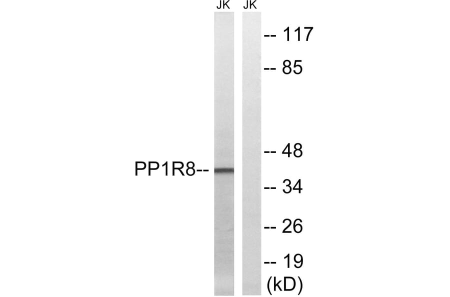 Western Blot - Anti-PPP1R8 Antibody (C17084) - Antibodies.com