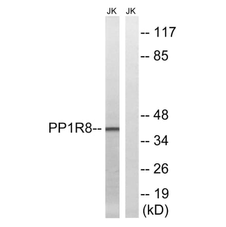 Western Blot - Anti-PPP1R8 Antibody (C17084) - Antibodies.com