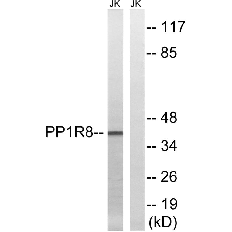 Western Blot - Anti-PPP1R8 Antibody (C17084) - Antibodies.com