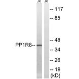 Western Blot - Anti-PPP1R8 Antibody (C17084) - Antibodies.com