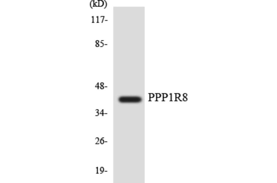 Western Blot - Anti-PPP1R8 Antibody (R12-3352) - Antibodies.com