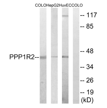 Western Blot - Anti-PPP1R2 Antibody (B8402) - Antibodies.com