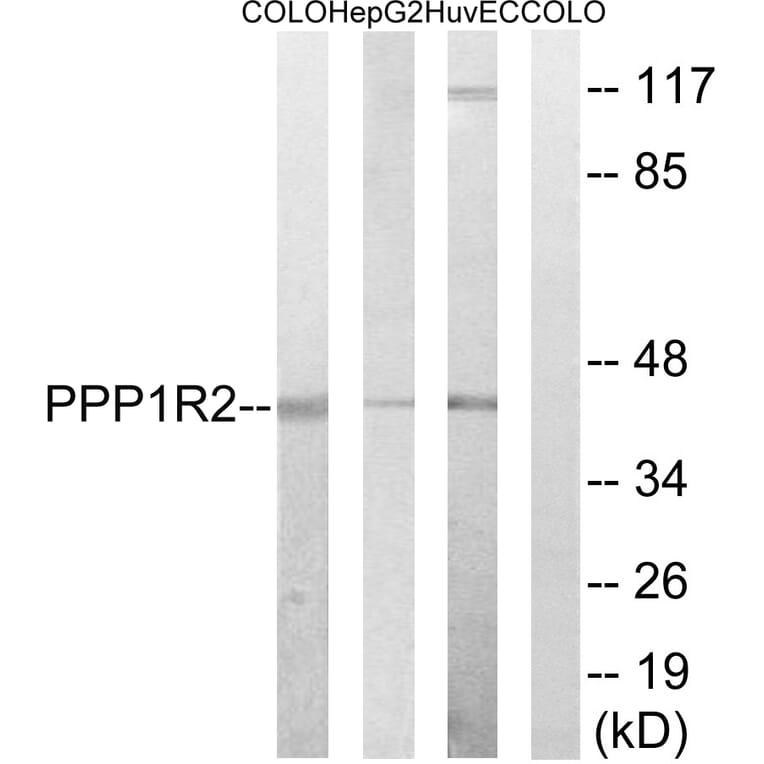 Western Blot - Anti-PPP1R2 Antibody (B8402) - Antibodies.com