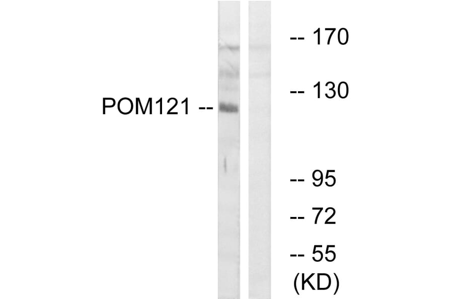 Western Blot - Anti-POM121 Antibody (C17074) - Antibodies.com