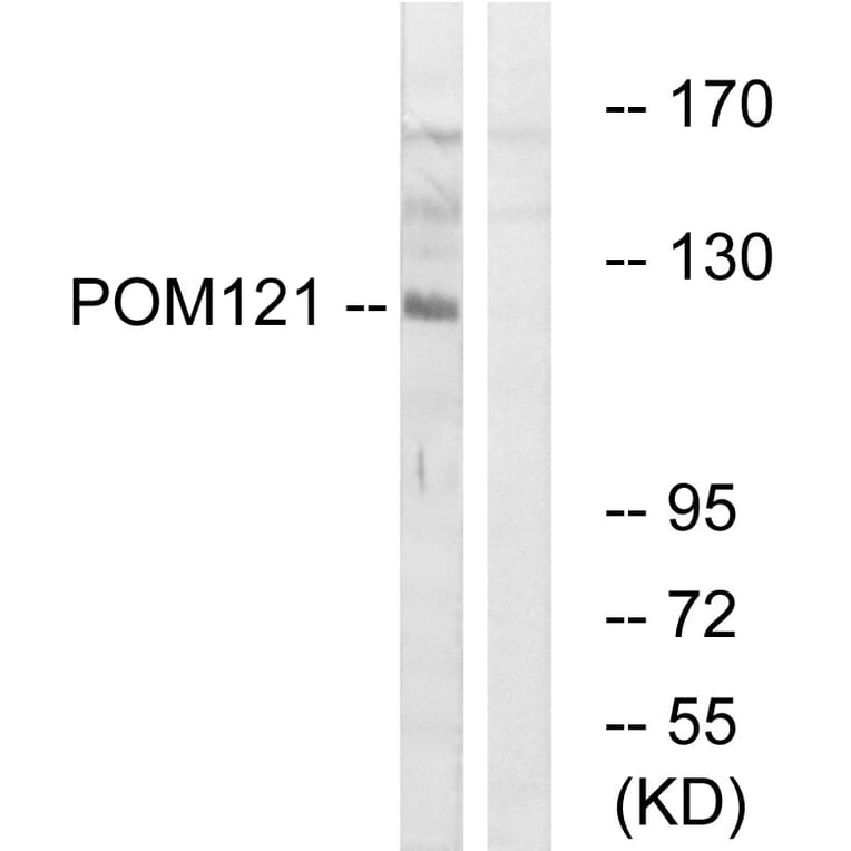 Western Blot - Anti-POM121 Antibody (C17074) - Antibodies.com