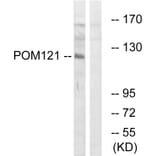 Western Blot - Anti-POM121 Antibody (C17074) - Antibodies.com