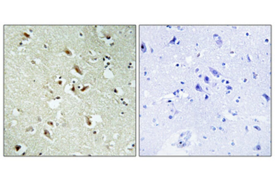 Immunohistochemistry - Anti-POM121 Antibody (C17074) - Antibodies.com