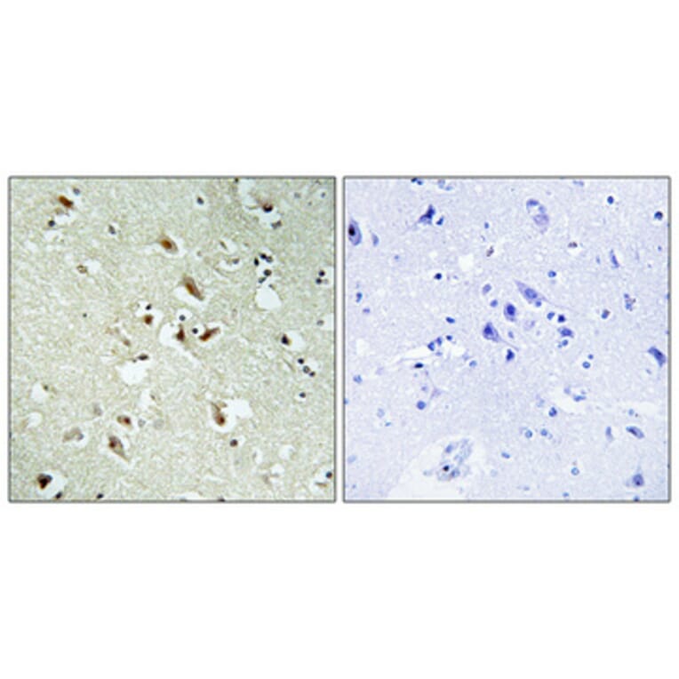 Immunohistochemistry - Anti-POM121 Antibody (C17074) - Antibodies.com