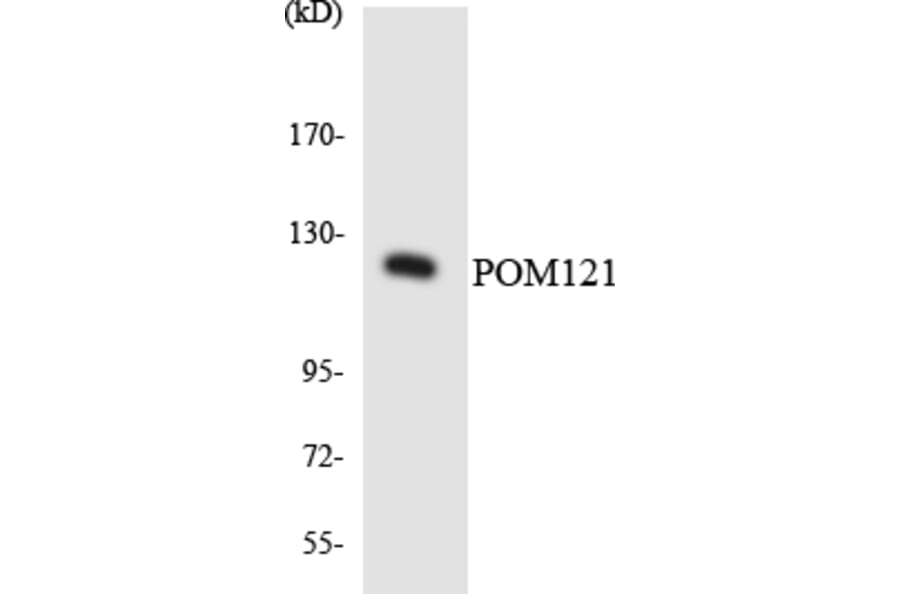 Western Blot - Anti-POM121 Antibody (R12-3345) - Antibodies.com