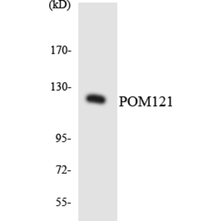 Western Blot - Anti-POM121 Antibody (R12-3345) - Antibodies.com