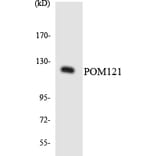 Western Blot - Anti-POM121 Antibody (R12-3345) - Antibodies.com