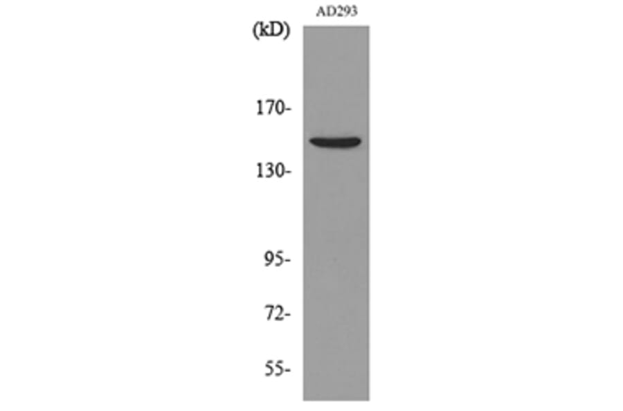 Western Blot - Anti-PNPLA6 Antibody (C30066) - Antibodies.com