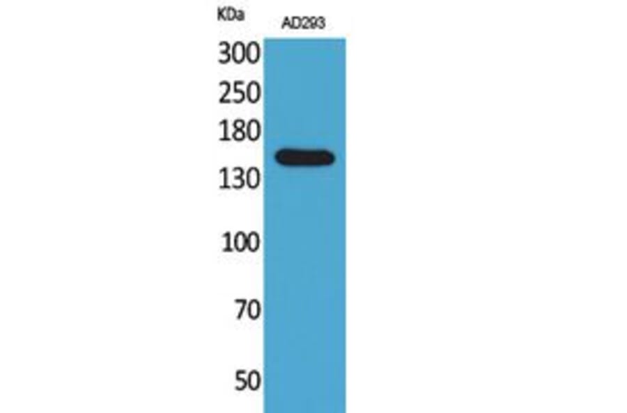 Western Blot - Anti-PNPLA6 Antibody (C30066) - Antibodies.com