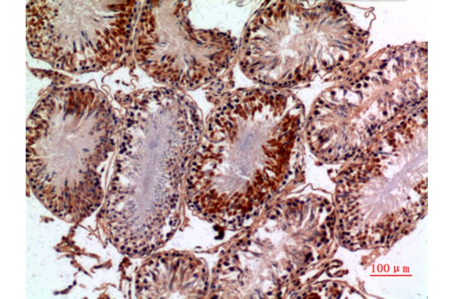 Immunohistochemistry - Anti-PNPLA6 Antibody (C30066) - Antibodies.com