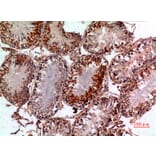 Immunohistochemistry - Anti-PNPLA6 Antibody (C30066) - Antibodies.com