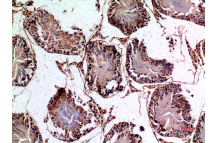 Immunohistochemistry - Anti-PNPLA6 Antibody (C30066) - Antibodies.com