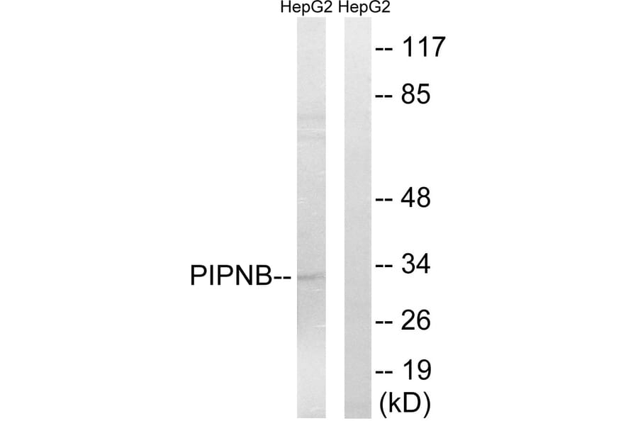 Western Blot - Anti-PITPNB Antibody (C17679) - Antibodies.com
