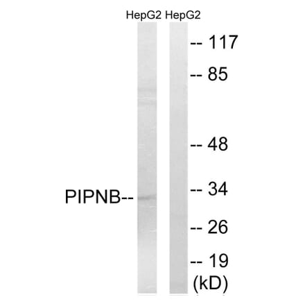 Western Blot - Anti-PITPNB Antibody (C17679) - Antibodies.com