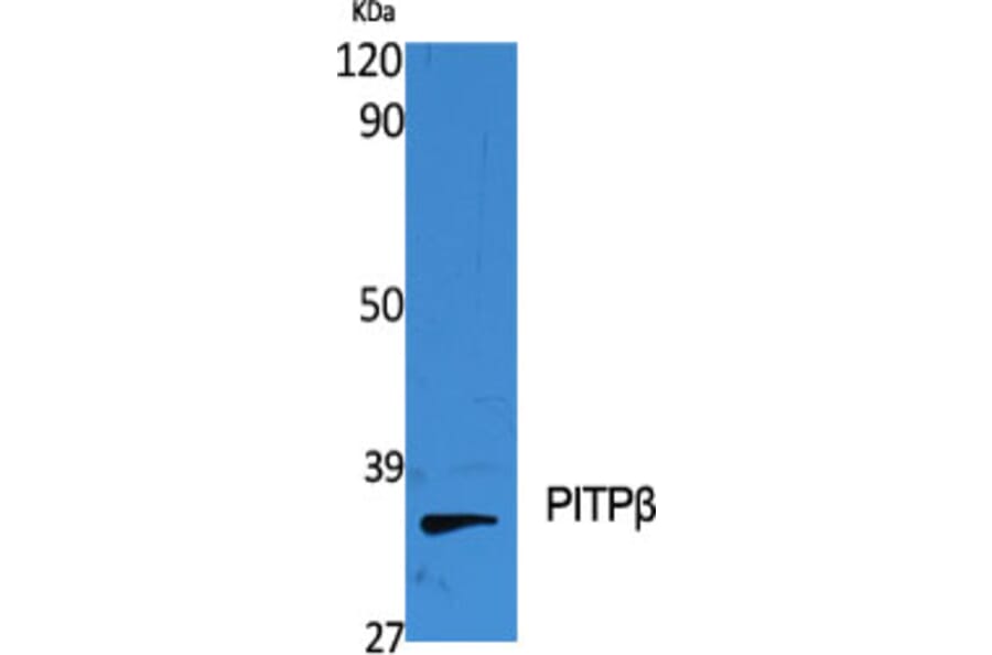 Western Blot - Anti-PITPNB Antibody (C17679) - Antibodies.com