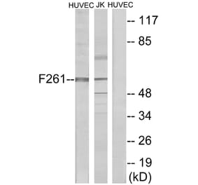 Western Blot - Anti-PFKFB1 Antibody (C10389) - Antibodies.com