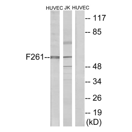 Western Blot - Anti-PFKFB1 Antibody (C10389) - Antibodies.com