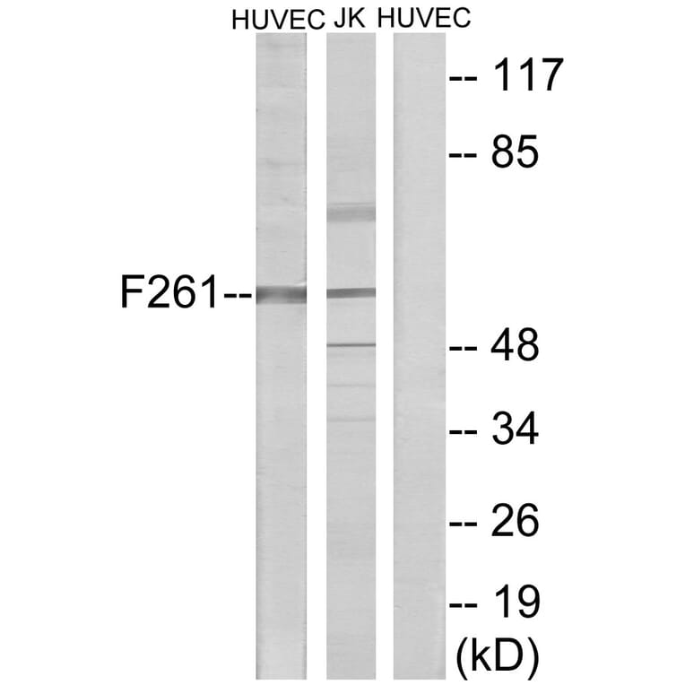 Western Blot - Anti-PFKFB1 Antibody (C10389) - Antibodies.com