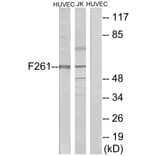 Western Blot - Anti-PFKFB1 Antibody (C10389) - Antibodies.com