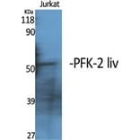 Western Blot - Anti-PFKFB1 Antibody (C10389) - Antibodies.com