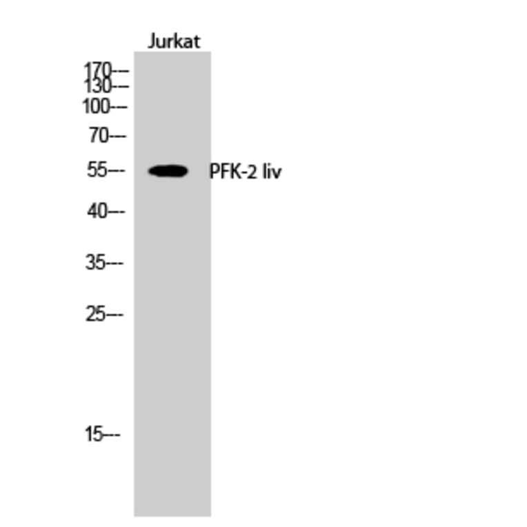 Western Blot - Anti-PFKFB1 Antibody (C10389) - Antibodies.com