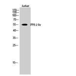 Western Blot - Anti-PFKFB1 Antibody (C10389) - Antibodies.com