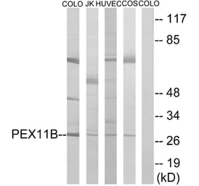 Western Blot - Anti-PEX11B Antibody (C17630) - Antibodies.com