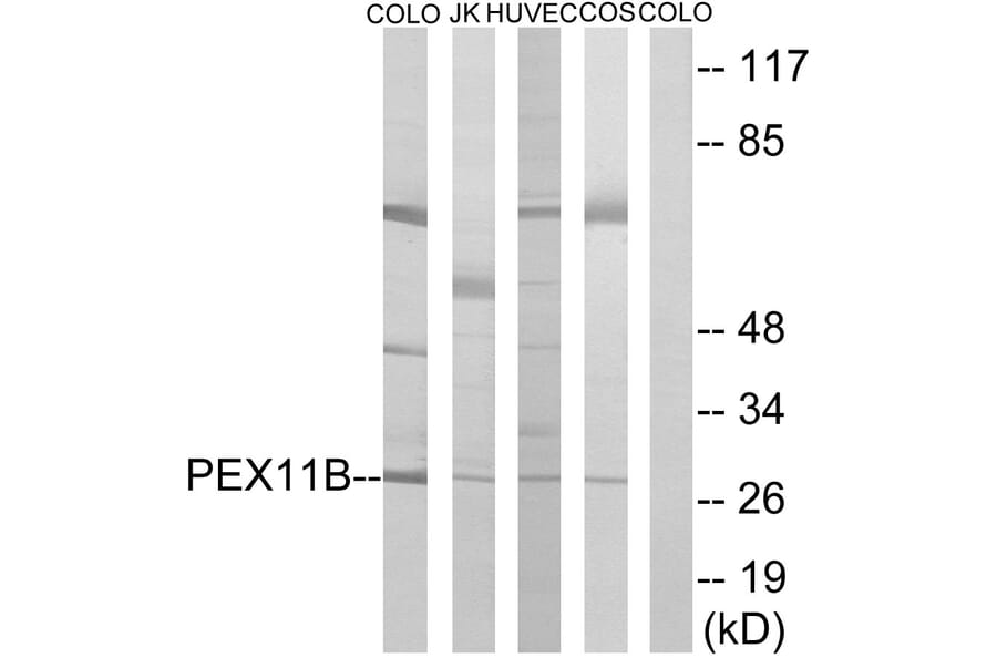 Western Blot - Anti-PEX11B Antibody (C17630) - Antibodies.com