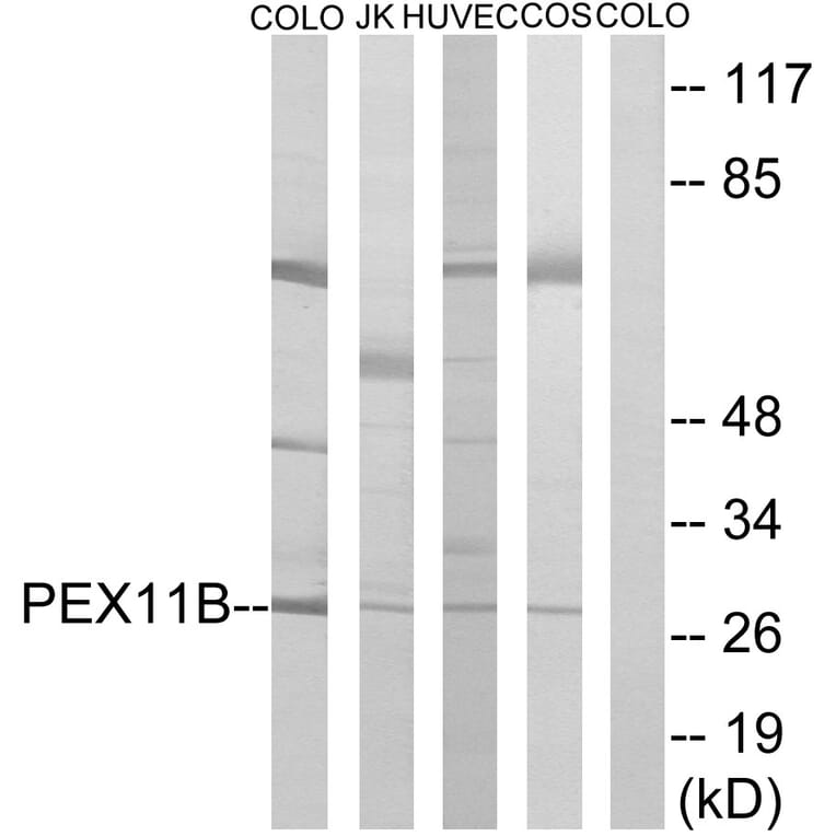 Western Blot - Anti-PEX11B Antibody (C17630) - Antibodies.com