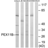 Western Blot - Anti-PEX11B Antibody (C17630) - Antibodies.com