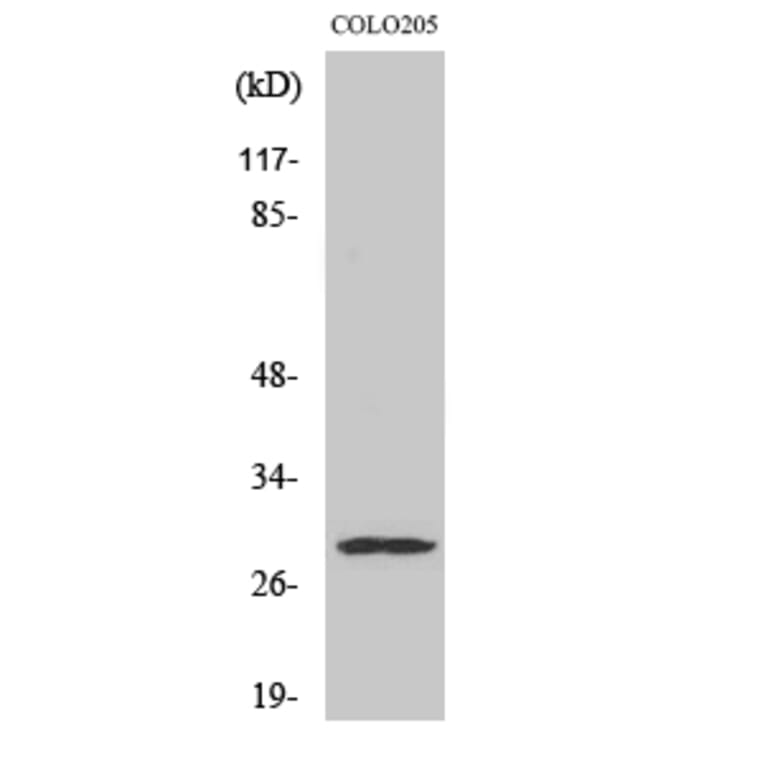 Western Blot - Anti-PEX11B Antibody (C17630) - Antibodies.com