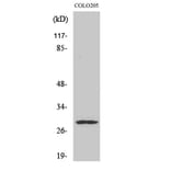 Western Blot - Anti-PEX11B Antibody (C17630) - Antibodies.com