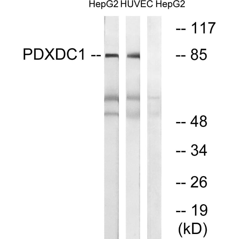 Western Blot - Anti-PDXDC1 Antibody (C18098) - Antibodies.com