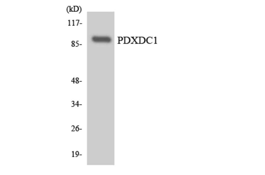 Western Blot - Anti-PDXDC1 Antibody (R12-3310) - Antibodies.com