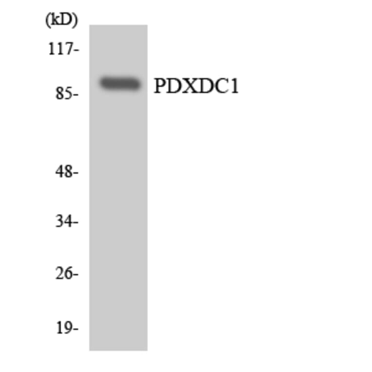 Western Blot - Anti-PDXDC1 Antibody (R12-3310) - Antibodies.com