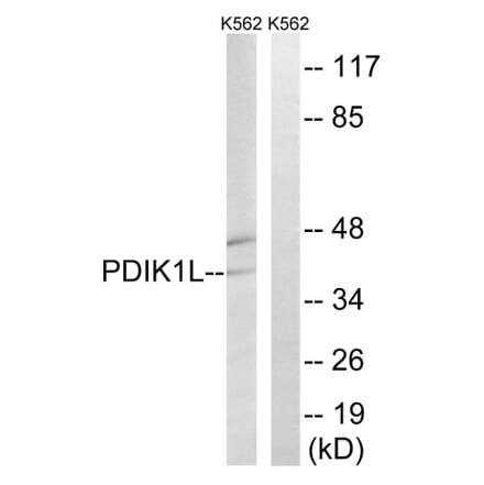 Western Blot - Anti-PDIK1L Antibody (C18591) - Antibodies.com