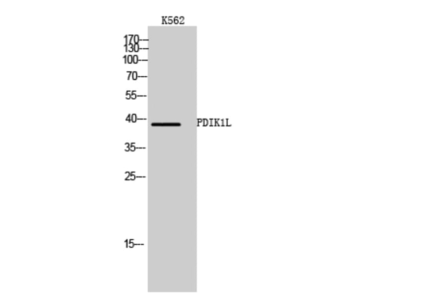 Western Blot - Anti-PDIK1L Antibody (C18591) - Antibodies.com