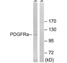 Western Blot - Anti-PDGFRa Antibody (B8210) - Antibodies.com