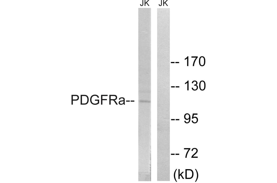 Western Blot - Anti-PDGFRa Antibody (B8210) - Antibodies.com