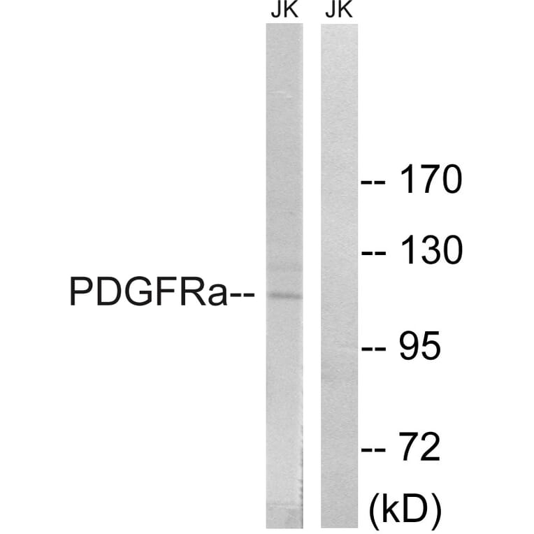 Western Blot - Anti-PDGFRa Antibody (B8210) - Antibodies.com