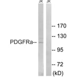 Western Blot - Anti-PDGFRa Antibody (B8210) - Antibodies.com