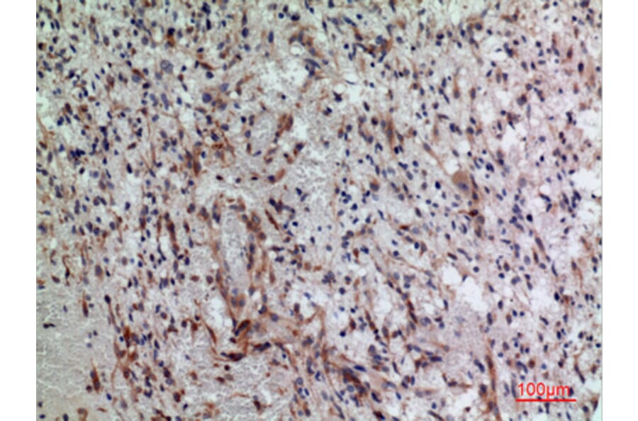 Immunohistochemistry - Anti-PDGFRA Antibody (C30433) - Antibodies.com