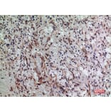 Immunohistochemistry - Anti-PDGFRA Antibody (C30433) - Antibodies.com