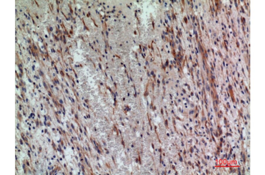 Immunohistochemistry - Anti-PDGFRA Antibody (C30433) - Antibodies.com