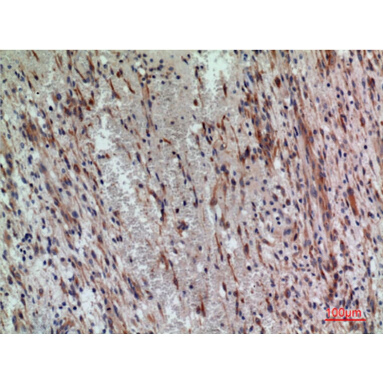 Immunohistochemistry - Anti-PDGFRA Antibody (C30433) - Antibodies.com